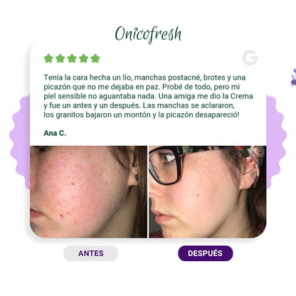 Crema Antihongos CUERPO y ZONAS SENSIBLES 75 ml