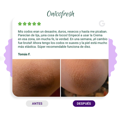 Crema Antihongos CUERPO y ZONAS SENSIBLES 75 ml