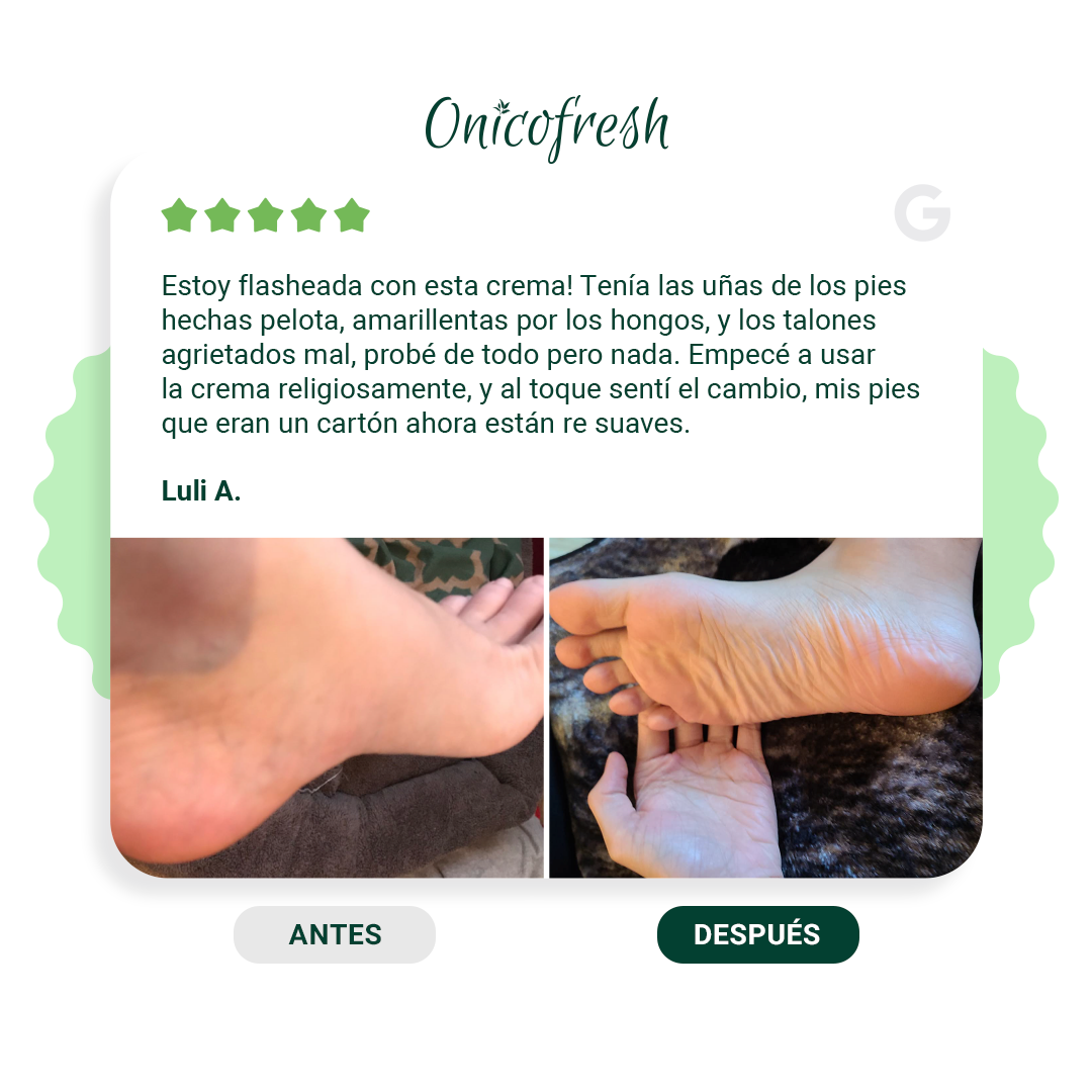 Kit Antihongos Crema Manos y Pies + Crema Corporal 75 ml c/u