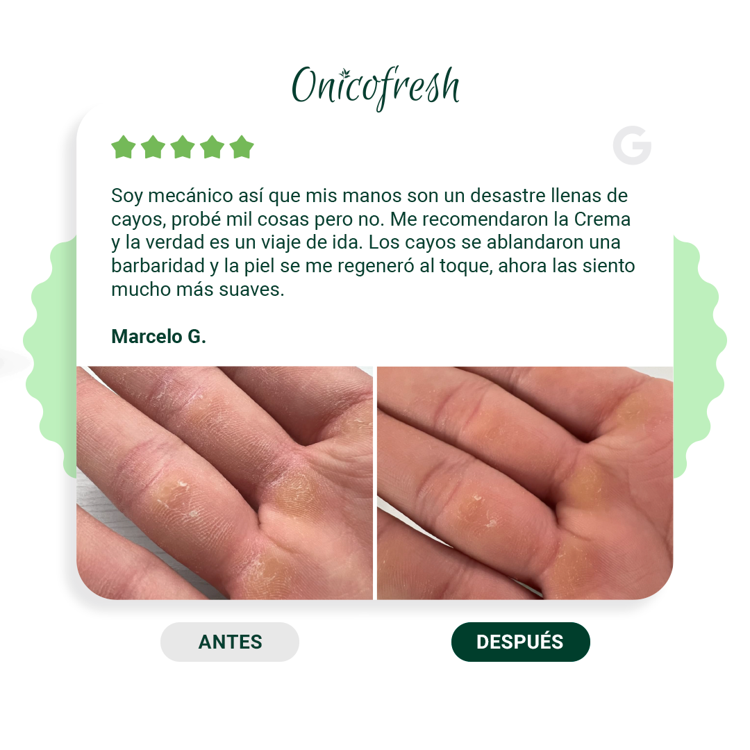 Kit Antihongos Crema Manos y Pies + Crema Corporal 75 ml c/u