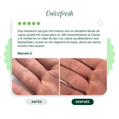 Kit Antihongos Crema Manos y Pies + Crema Corporal 75 ml c/u