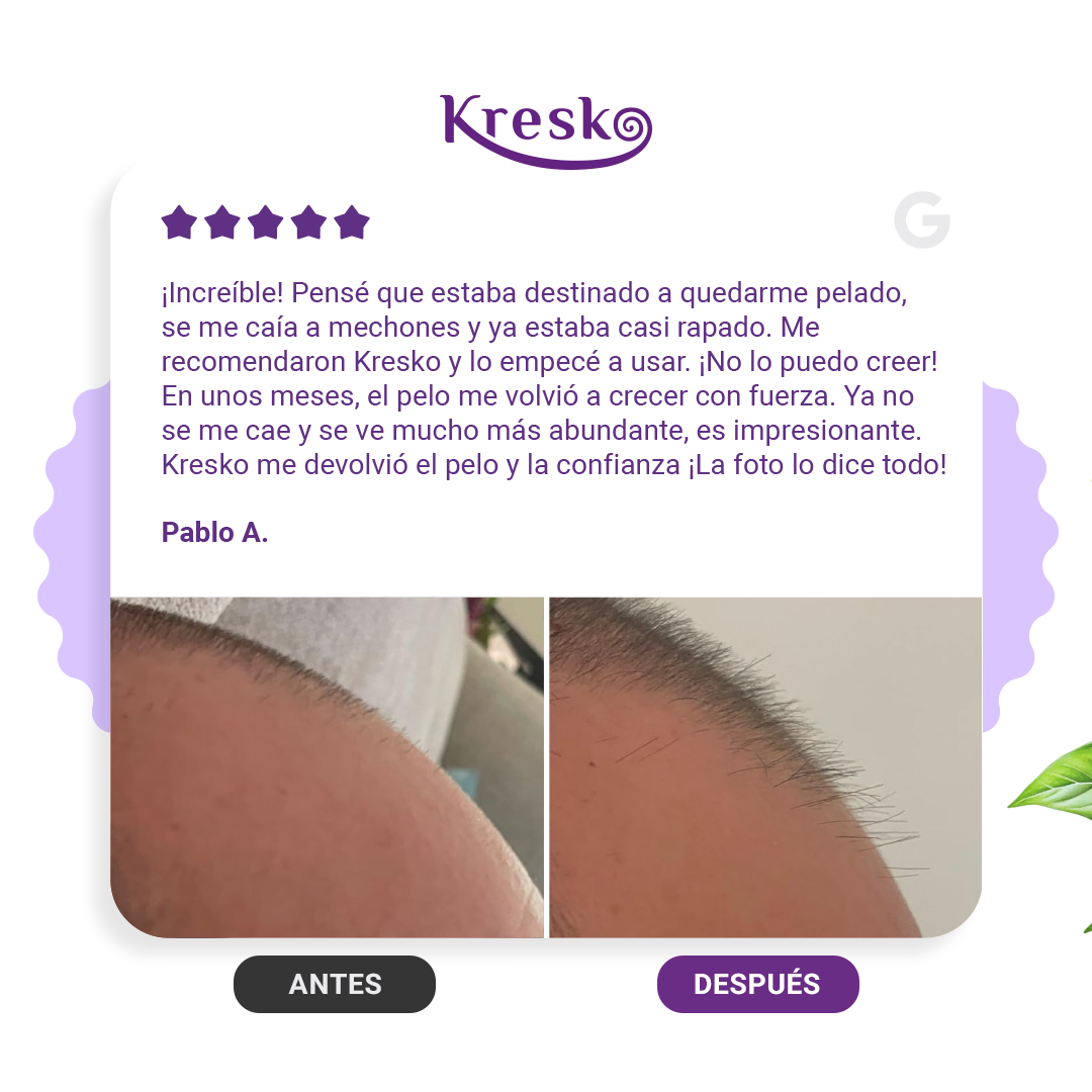 Shampoo Anticaída 300 ml